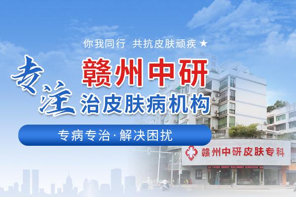贛州中研皮膚研究院怎么到 局部白癜風擴散怎么辦? 600-400專注皮膚病2.jpg