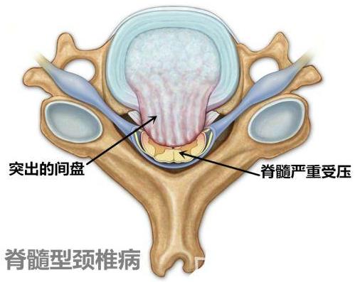 重慶頸椎病骨科醫(yī)院哪家好?重慶紅樓醫(yī)院正規(guī)公辦醫(yī)院