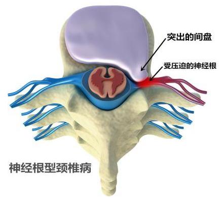 重慶頸椎病骨科醫(yī)院哪家好?重慶紅樓醫(yī)院正規(guī)公辦醫(yī)院