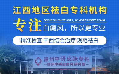贛州中研皮膚病醫院治療的效果怎樣?檢查白癜風要做什么項目?