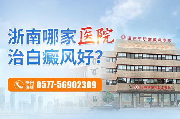 溫州中研白癜風醫院可靠嗎?白癜風為什么會出現擴散呢