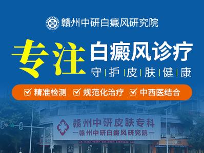 贛州中研白癜風(fēng)研究院應(yīng)該怎么走 激素治療白癜風(fēng)怎么樣?