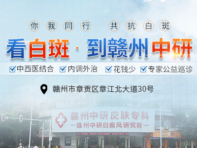 贛州中研白癜風醫院趙玉華主治醫師詳解:不得而知的白癜風危害!