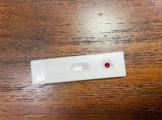 hiv試紙檢測準確嗎?hiv試紙血量少會怎樣