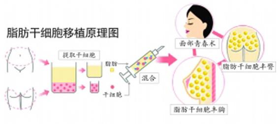 怎么填充太陽穴才能避免臉變大,有太陽穴凹陷的人來看看【劉靖濤填充醫生】