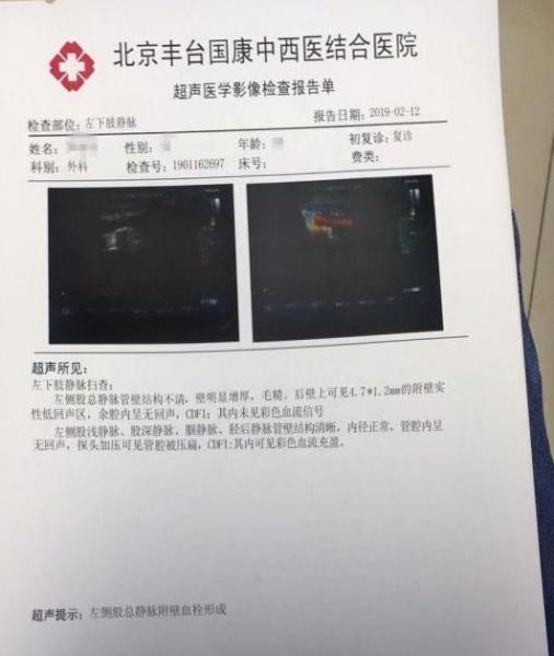 靜脈血栓轉變老爛腿 北京國康醫院劉繼前僅用半個月保肢