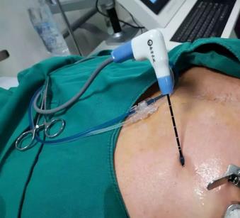 廣州復大腫瘤醫院評價 履行社會責任做一家有擔當的醫院
