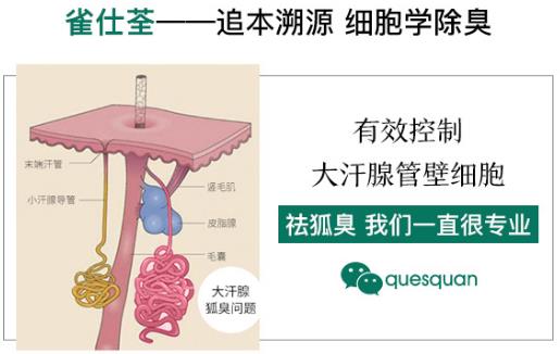 治狐臭的藥哪個最好 挑選是需要必備條件的