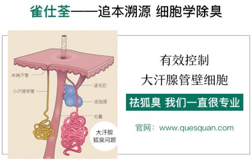 治狐臭最好的藥是哪個(gè) 讓您更專(zhuān)業(yè)的得到清香