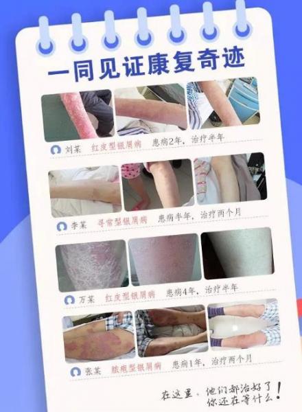 長春華山皮膚病醫院誠邀葛蒙梁教授坐診第13次聯合會診