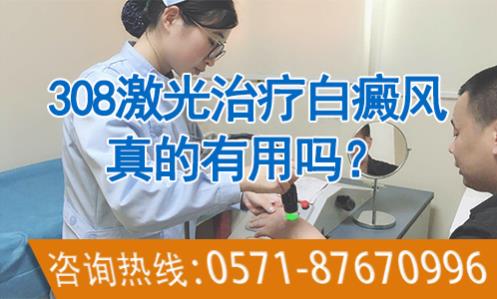 華研白癜風醫(yī)院的308激光治療效果怎么樣?前端技術,值得相信