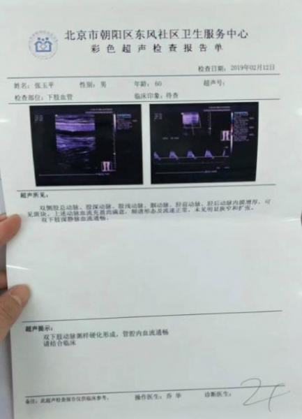 劉繼前技術怎么樣 動脈硬化患者在國康醫院完全康復