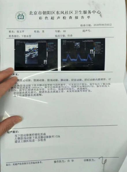 劉繼前技術怎么樣 動脈硬化患者在國康醫院完全康復