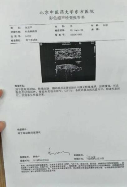 劉繼前技術怎么樣 動脈硬化患者在國康醫院完全康復
