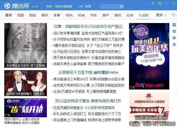 四川結石病醫院服務怎么樣 專業贏在優質服務