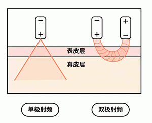 【武漢藝星整形醫院】一篇文章讓你讀懂抗衰神器“熱瑪吉”! 9.gif