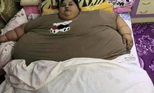 世界上最胖的人 725公斤蘇珊娜·埃曼自認(rèn)為是個大美女