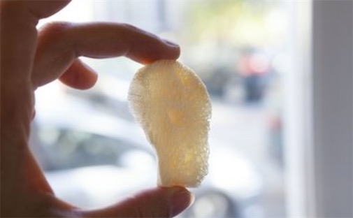 最早的骨移植手術 明代接骨名醫陳典有接骨神術