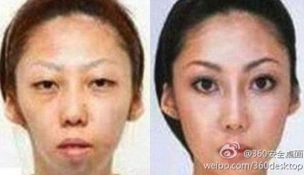【老婆太丑】老婆漂亮女兒太丑,男子告整容老婆獲賠75萬,是整容醫院炒作嗎