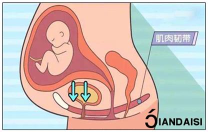 產(chǎn)后縮陰怎么做?8個(gè)建議