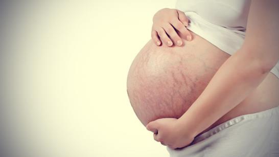 “好孕”時光——Skinception去妊娠紋霜讓你孕后無憂