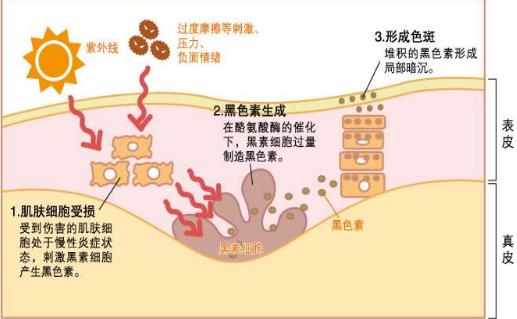 祛斑產(chǎn)品哪個效果好 正確祛斑我們先要知道這些