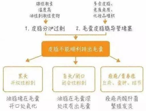 北京伊美爾幸福醫(yī)院:閉口粉刺會(huì)自己慢慢消失嗎?