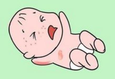 嬰兒濕疹怎么辦?寶寶濕疹怎么引起的