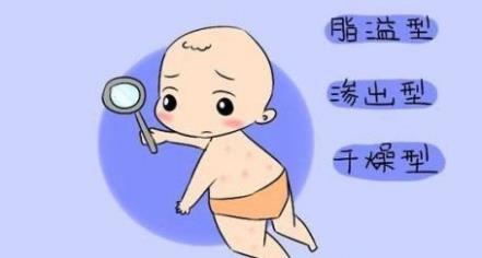 寶寶臉上濕疹,新生兒濕疹怎么辦?