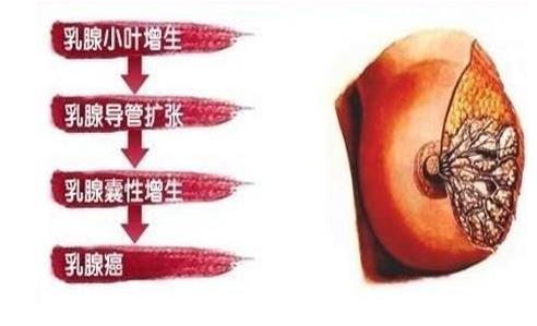 乳腺增生對懷孕有沒有影響 乳腺增該吃的3種食物