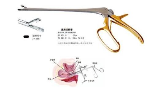 宮頸活檢費用是多少 宮頸活檢的注意事項