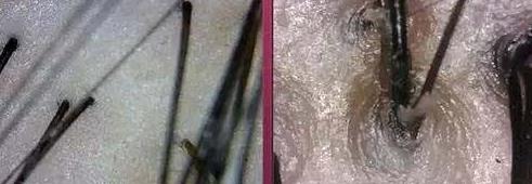 你知道頭皮的真實狀況嗎?青逸植發告訴你:發質不好是因為