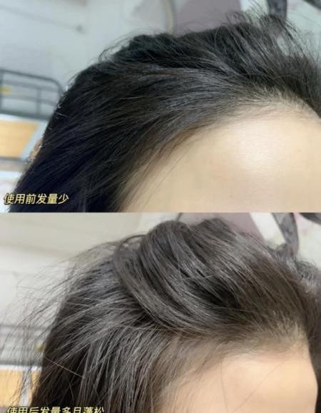 人一天掉多少頭發?解決脫發問題原來靠這招!