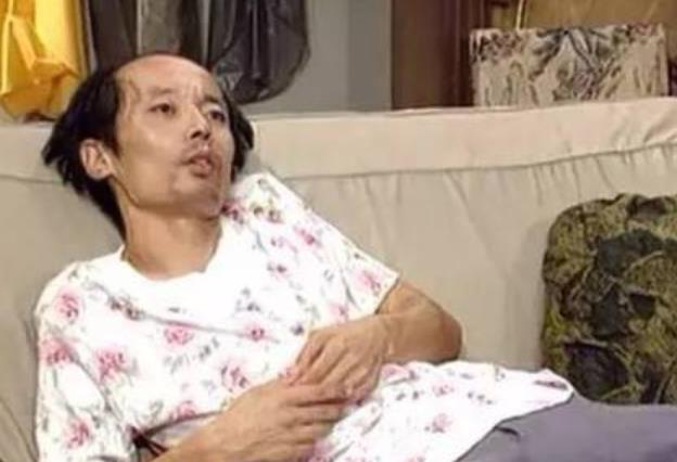 高溫悶熱的大夏天頭發掉的越厲害 中醫揭露6大致命脫發原因