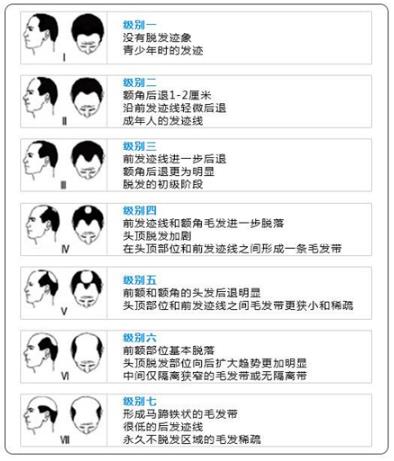 重慶萊森植發怎么樣 想要解決脫發禿頂