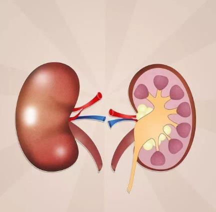 腎功能不全的癥狀是什么?腎功能不全怎么辦
