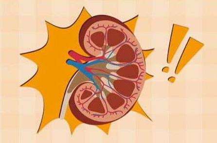 慢性腎功能不全是什么?慢性腎功能不全的原因