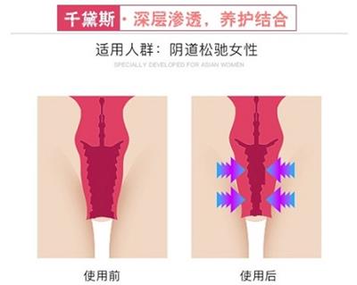 千黛斯怎么樣有沒有效果?牢記3點信心十足!