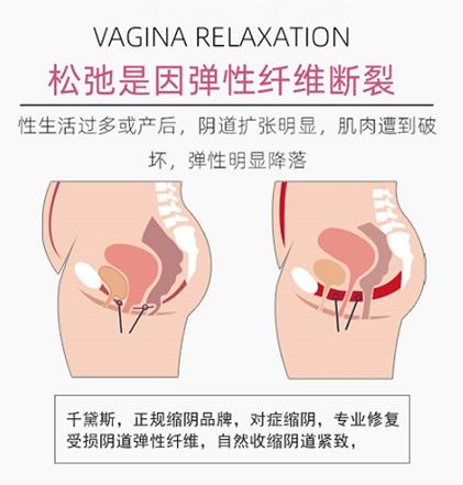 縮陰藥物有效果嗎?推薦一個用了能變緊的