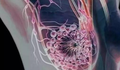 乳腺小結節的危害是什么?乳腺小結節不能吃什么