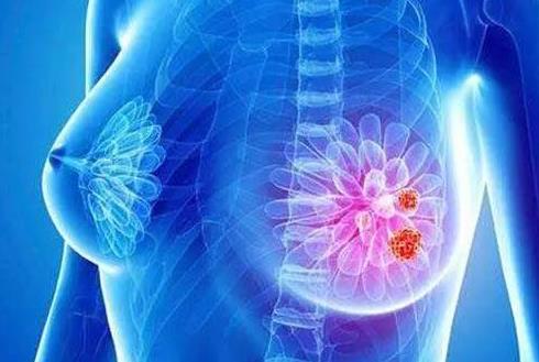乳腺小結節的危害是什么?乳腺小結節不能吃什么