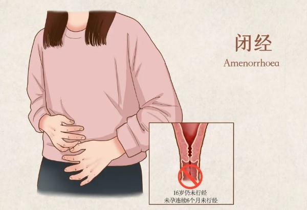 閉經是怎么回事?造成閉經的原因有哪些?
