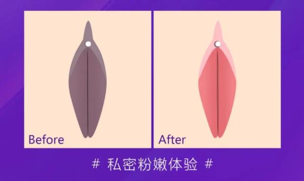 女生那里變黑是怎么回事