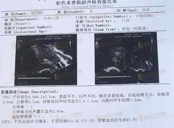 子宮腺肌癥能保住子宮嗎?50歲包大姐終于打贏這場長達20年的“子宮保衛戰”!