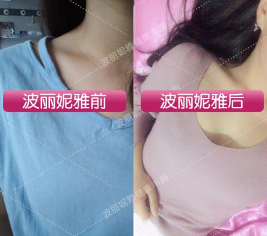 波麗妮雅用多久有效果 看看真實(shí)客戶的用戶反饋