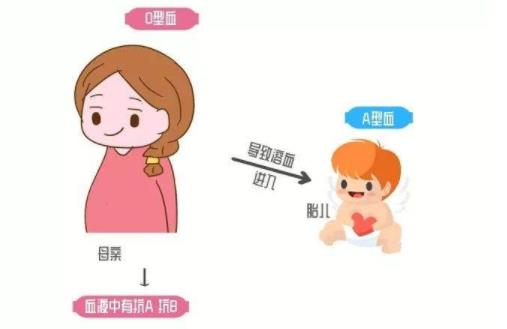 母兒血型不合溶血病 母兒血型不合的注意事項