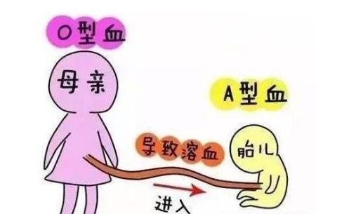 母兒血型不合溶血病 母兒血型不合的注意事項