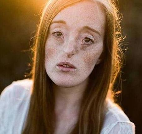 世界上最丑的5個(gè)女模特排名,梅勒妮·蓋多斯最令人驚訝