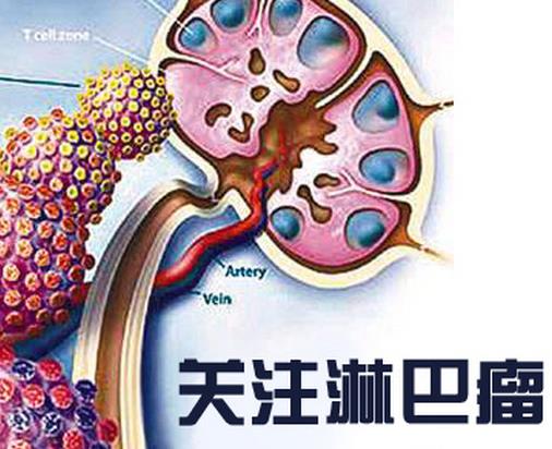 世界十大痛苦癌癥排行,胃癌發病率高,肺癌死亡率最快