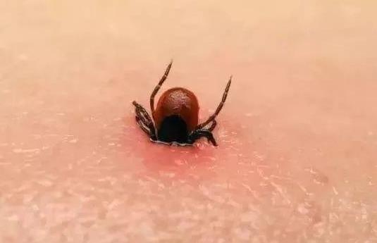 被蜱蟲咬了死亡率高嗎?被蜱蟲咬了一定會(huì)得病么?